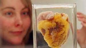 News Photo 1 - U.K. - Otta Nottathil - 22520234heart